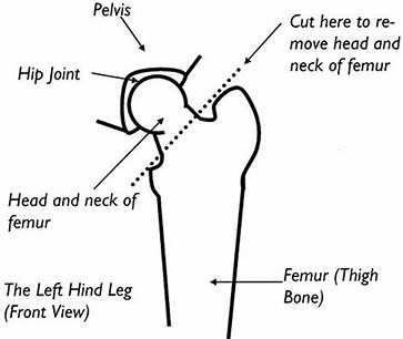 Legg Perthes Joint Removal Diagram